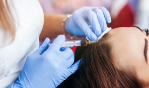 Exploring the benefits of PRP Treatment for Hair Loss